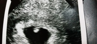 Mi diario de embarazo | Semana 6